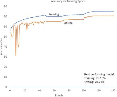 An automated heart rate-based algorithm for sleep stage classification: Validation using conventional polysomnography and an innovative wearable electrocardiogram device